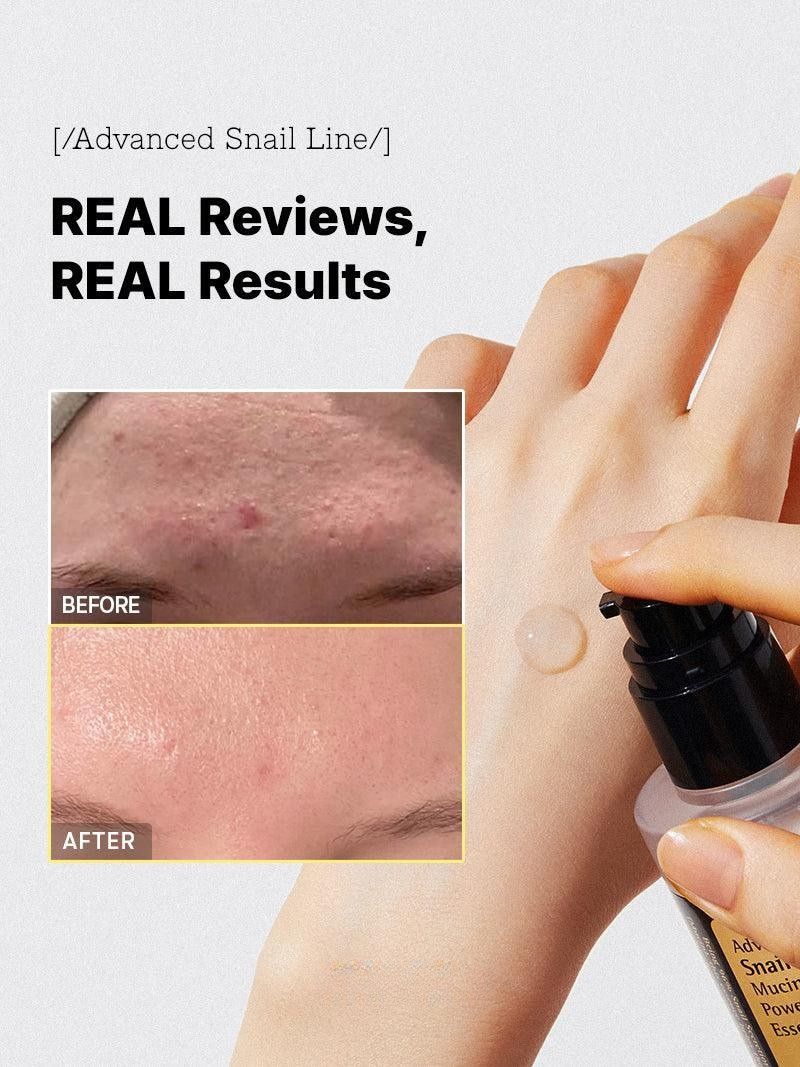 Snail 96 Mucin Essence (100ml × 2)