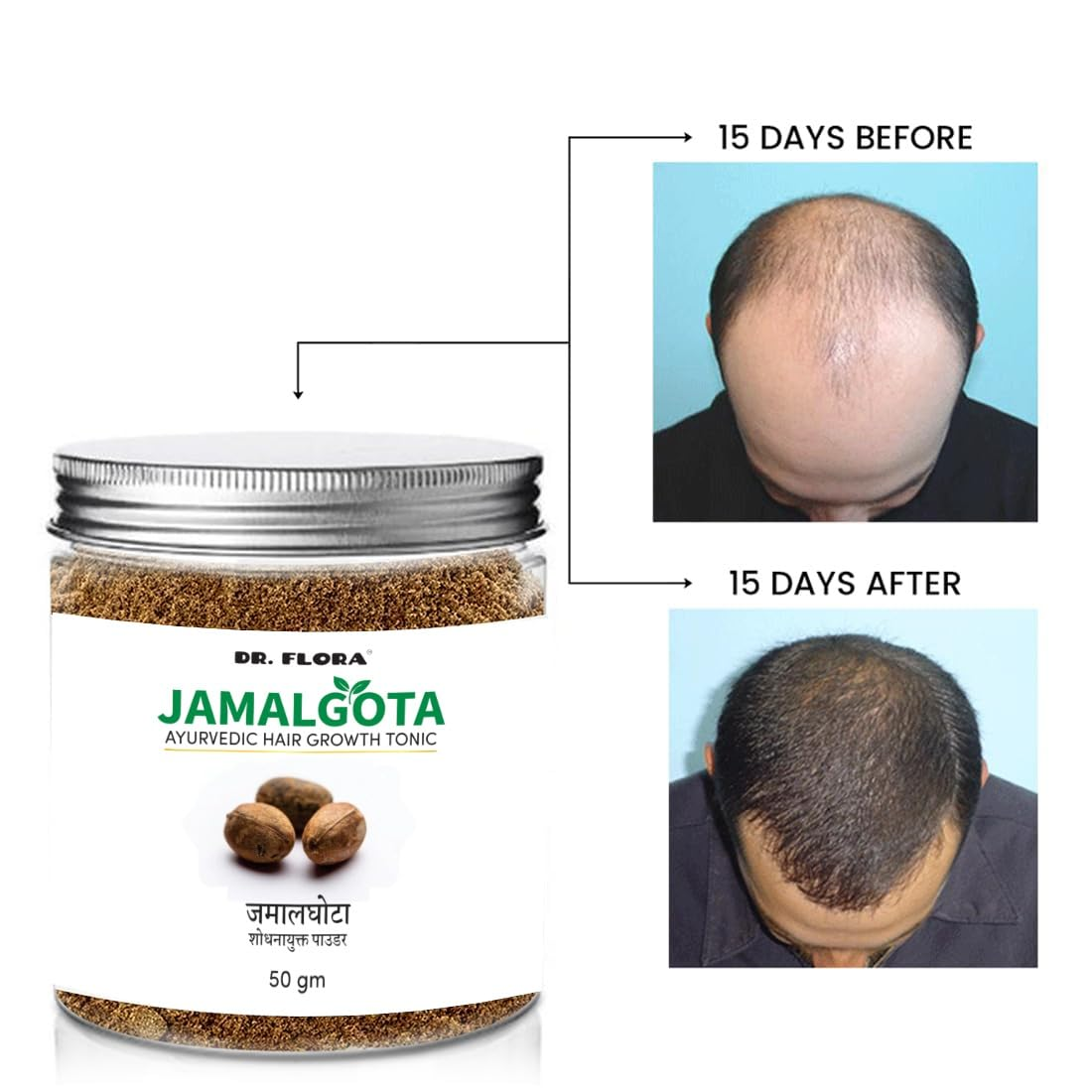 Jamalgota Ayurvedic Hair Growth Tonic Powder