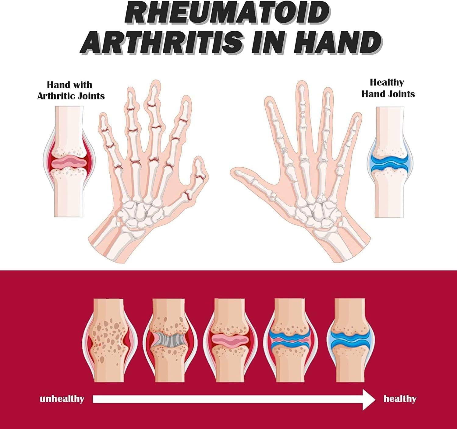 Original Perfectx Joint & Bone Therapy Cream (Pack of 2)