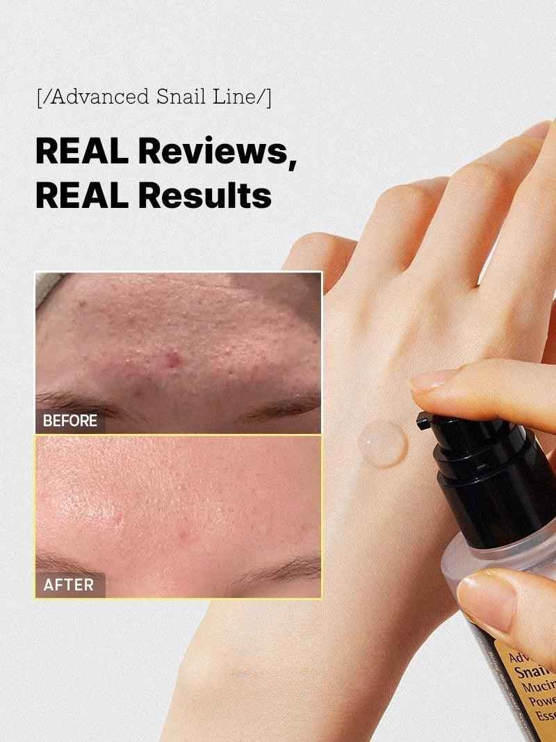 Snail 96 Mucin Essence (100ml × 2)