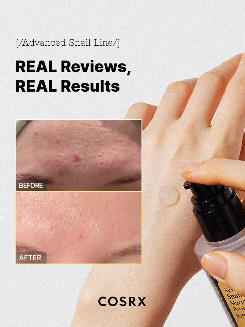 Advanced Snail 96% Mucin Power Essence (100ml)